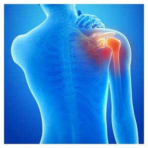 عکس رایگان کتف درد (درد در شانه)(Shoulder pain)